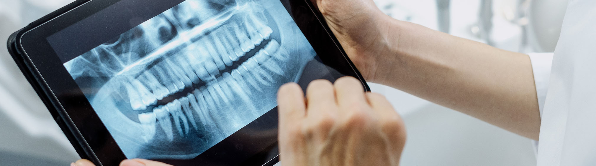 Person holding dental model